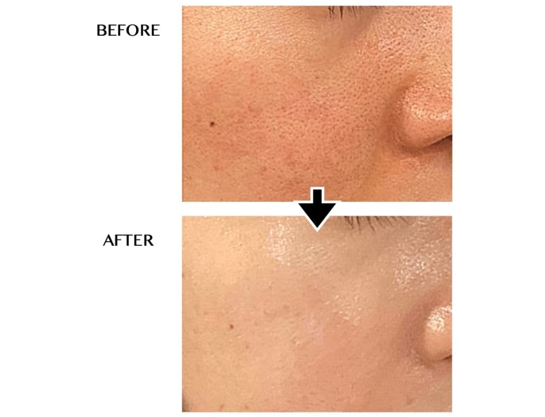 CELLZERO FAST 美容機器