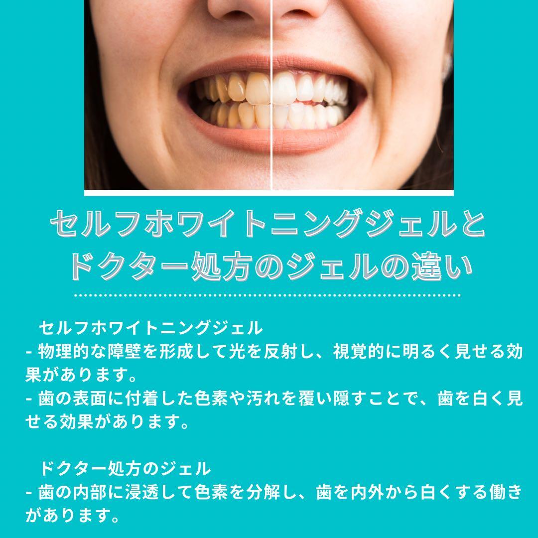 ホワイトニングマシン