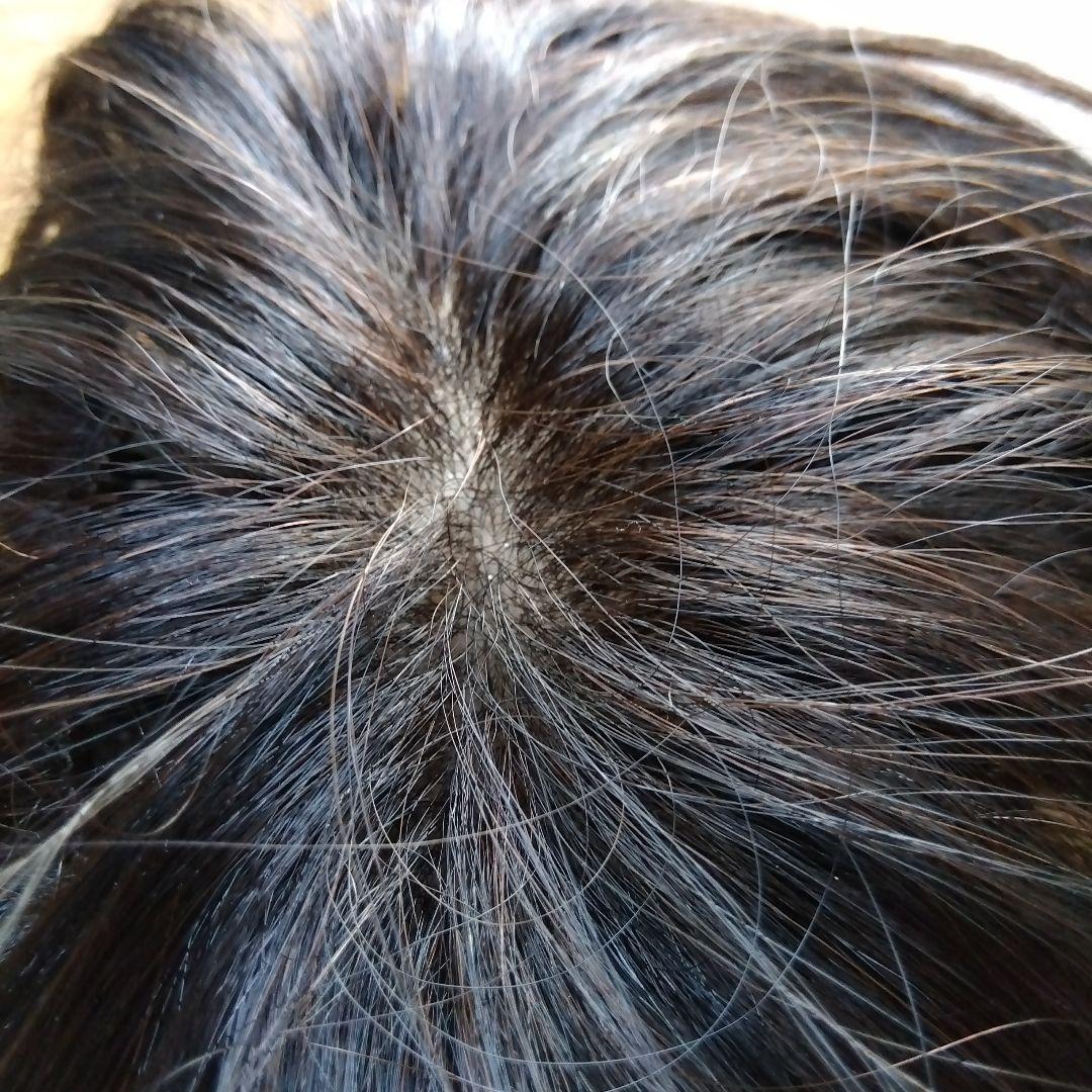 週末限定値下げ　レディースアートネイチャー　部分ウィッグ　頭頂部　ショート