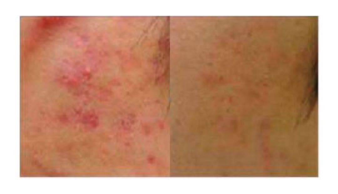 antimir アンティミル　真実の鏡 LED 美容