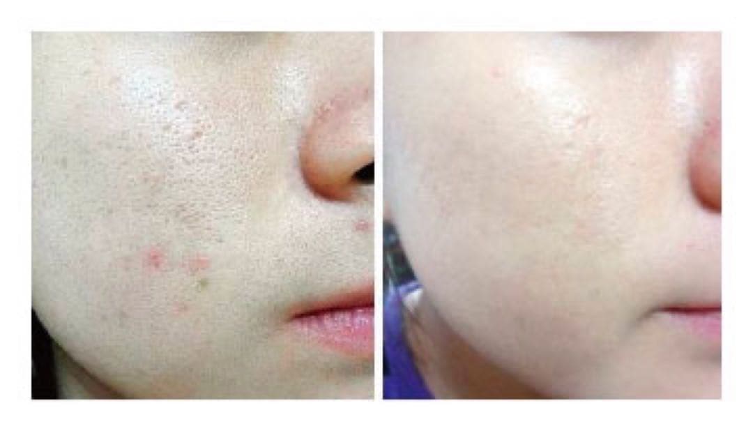 antimir アンティミル　真実の鏡 LED 美容