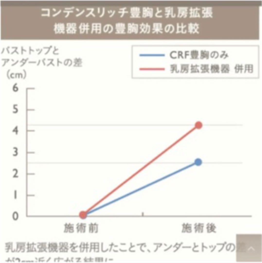 ⭐️半額以下‼︎‼︎⭐️ビブラ/豊胸/BEbraコンデンスリッチ/脂肪注入/バストアップ