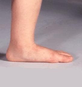 SK8INSOLL® DOUBLE AXEL カスタマイズインソール   XXS