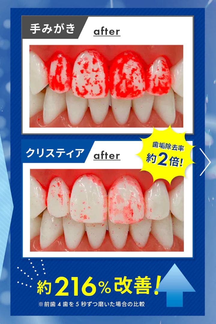 【未開封】電動歯ブラシ本体/替ブラシセット CLISTIA ホワイトエッセンス