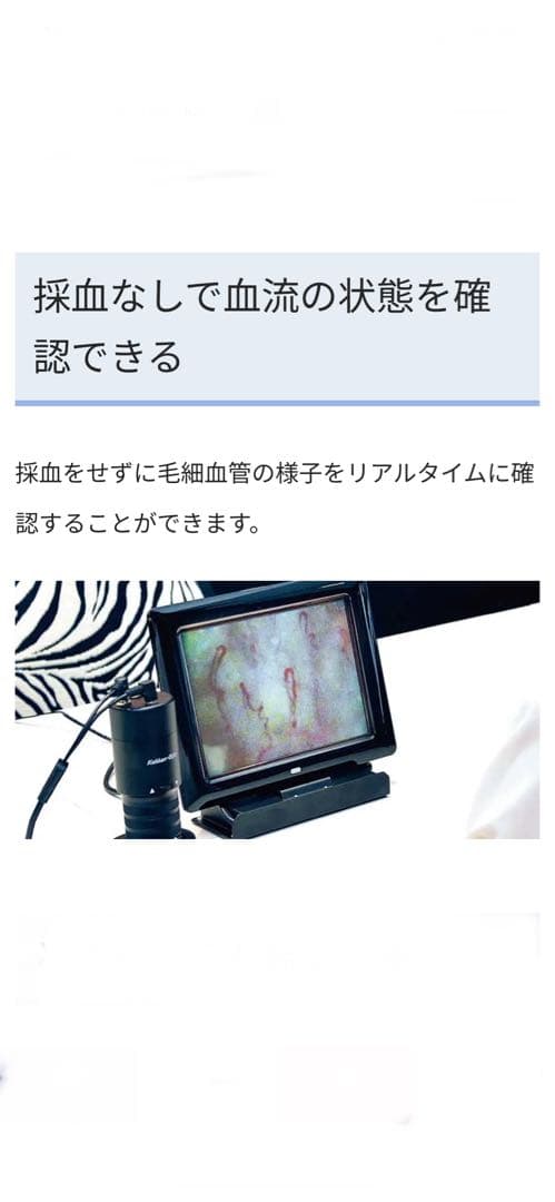 毛細血管スコープ　血管美人　SC-10