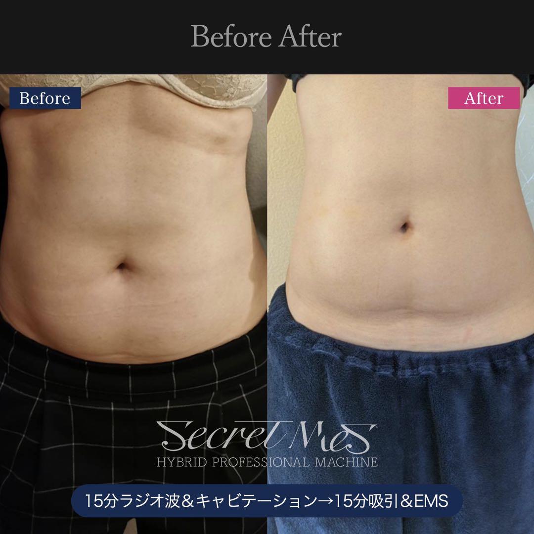 《美品》Secretmes 【シークレットメス】/限定2台/定価260万円