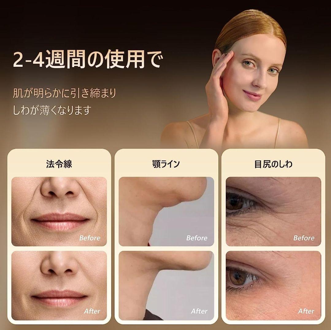 MEGELIN 美顔器 EMS ラジオ波 RF美容器 肌引き締め 表情筋ケア